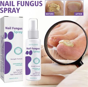 Nail Fungus Spray,Fungal Nail Treatment